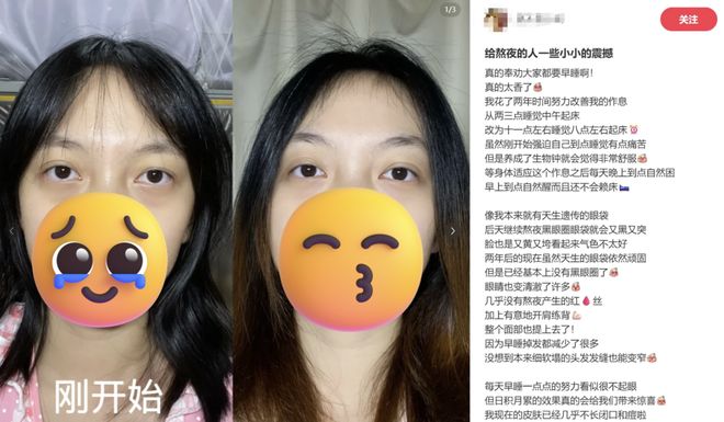 眼霜替代品__用什么替代眼霜