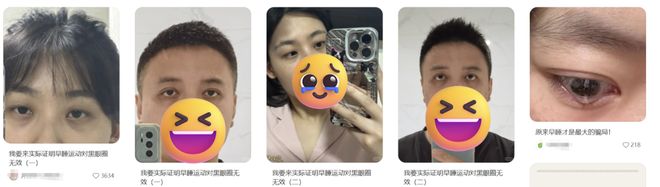 眼霜替代品_用什么替代眼霜_