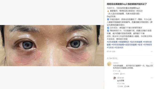 眼霜替代品__用什么替代眼霜