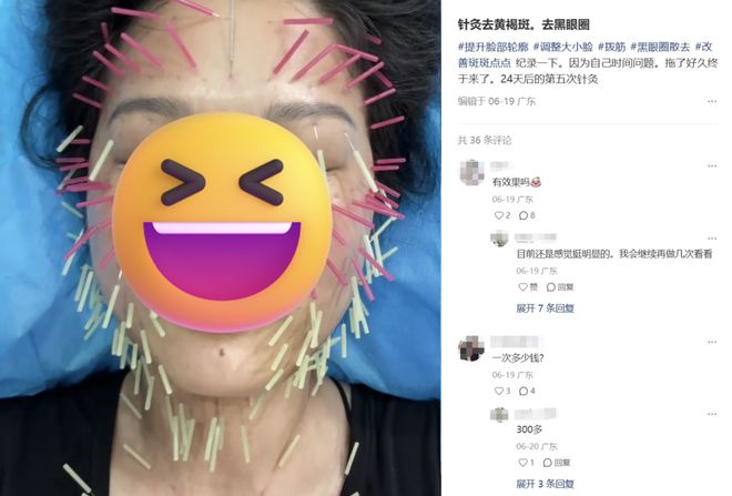_眼霜替代品_用什么替代眼霜