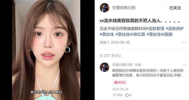 韩国整容术__韩国整容效果
