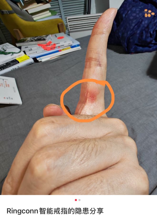 把手勒住会不会死_戴姆斯勒奔驰_