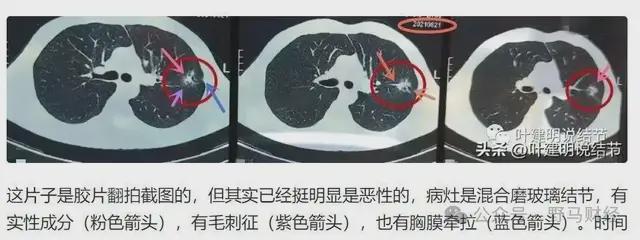 次责可以像主责要误工费吗_主责和次责保险是互赔_