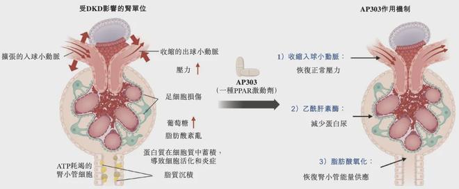_最大蓝海,肾脏病第一股亮相_最大蓝海,肾脏病第一股亮相
