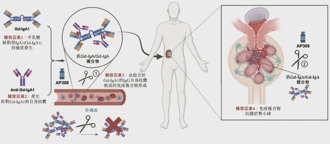 最大蓝海,肾脏病第一股亮相__最大蓝海,肾脏病第一股亮相