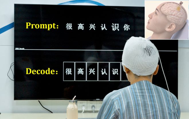 _马斯克对赌协议_马斯克喊单fil